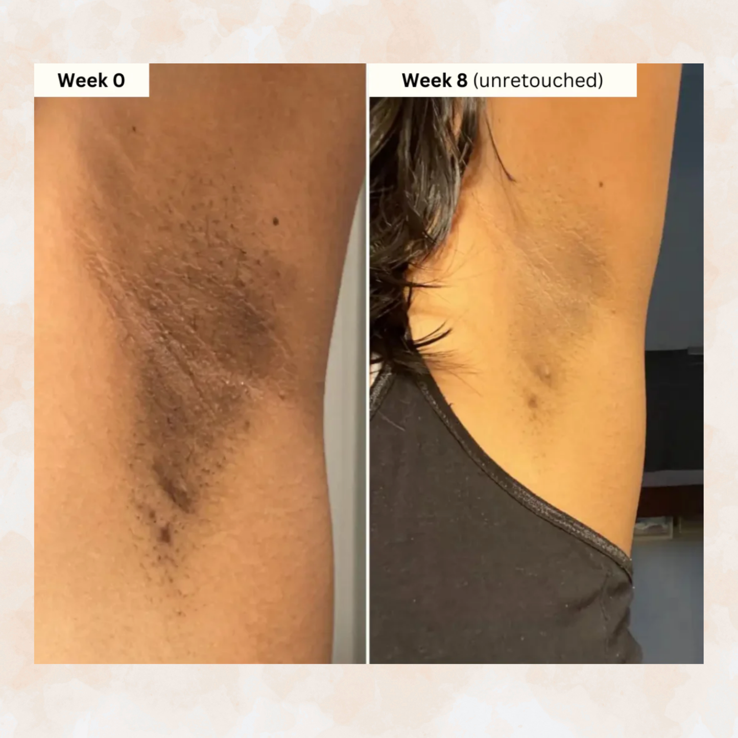 Turmeric Brightening Soap