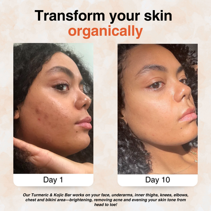 Turmeric Brightening Soap