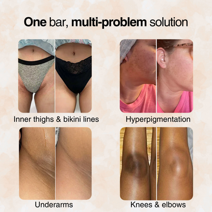 Turmeric Brightening Soap