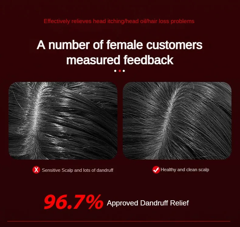 Electric Scalp Therapy Comb