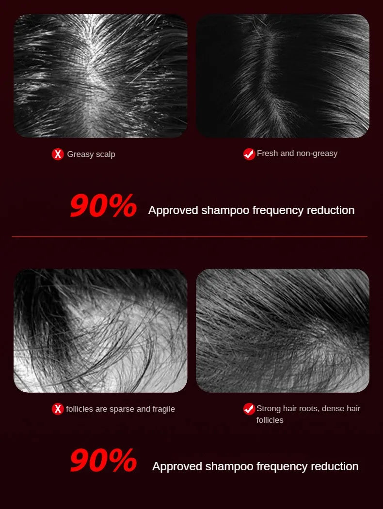 Electric Scalp Therapy Comb